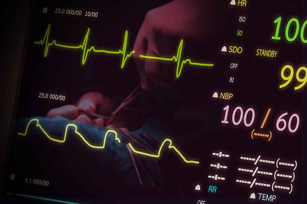 EKG Screen EKG Screen